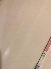 女性试管促排卵未成熟怎么办？未成熟的卵泡还能用吗？